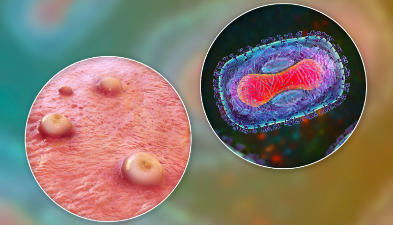 Ankara’da Gizemli Virüs İddiası: Gerçekler Neler?